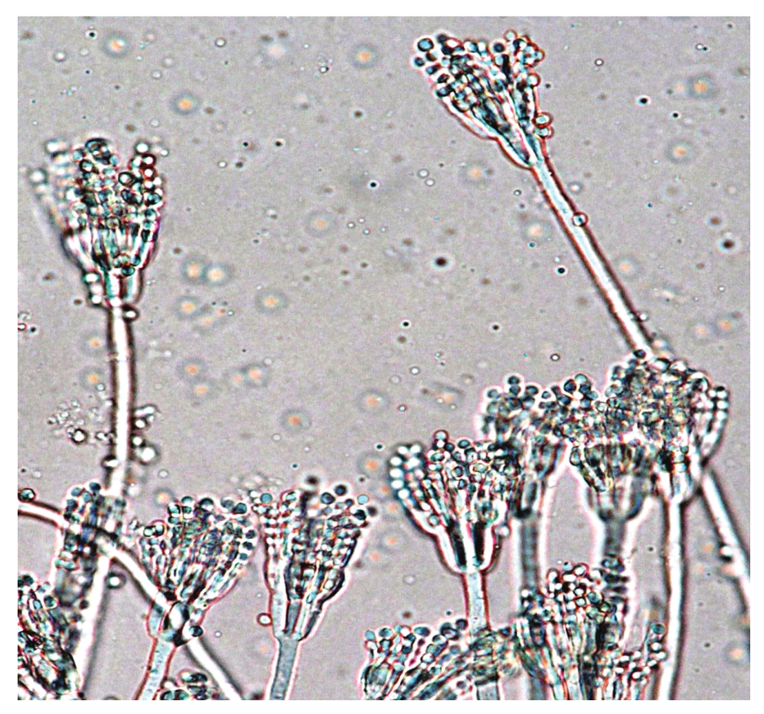 一、玉米真菌病害（Maize Diseases Caused by Fungus）_植保专题库